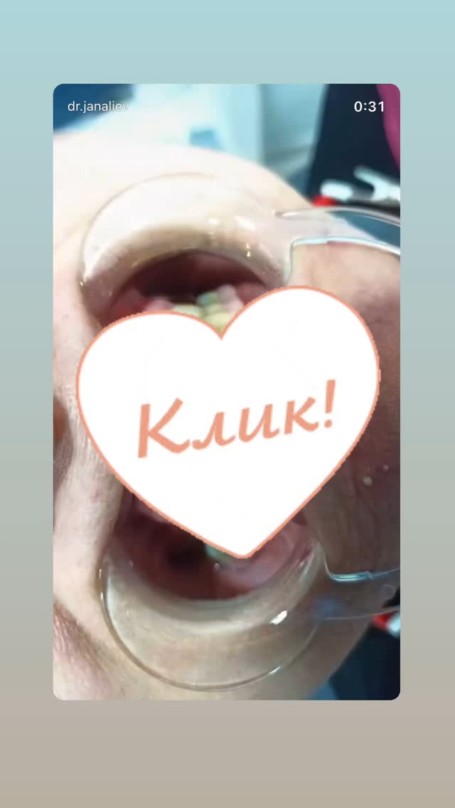 До/После — результат 2