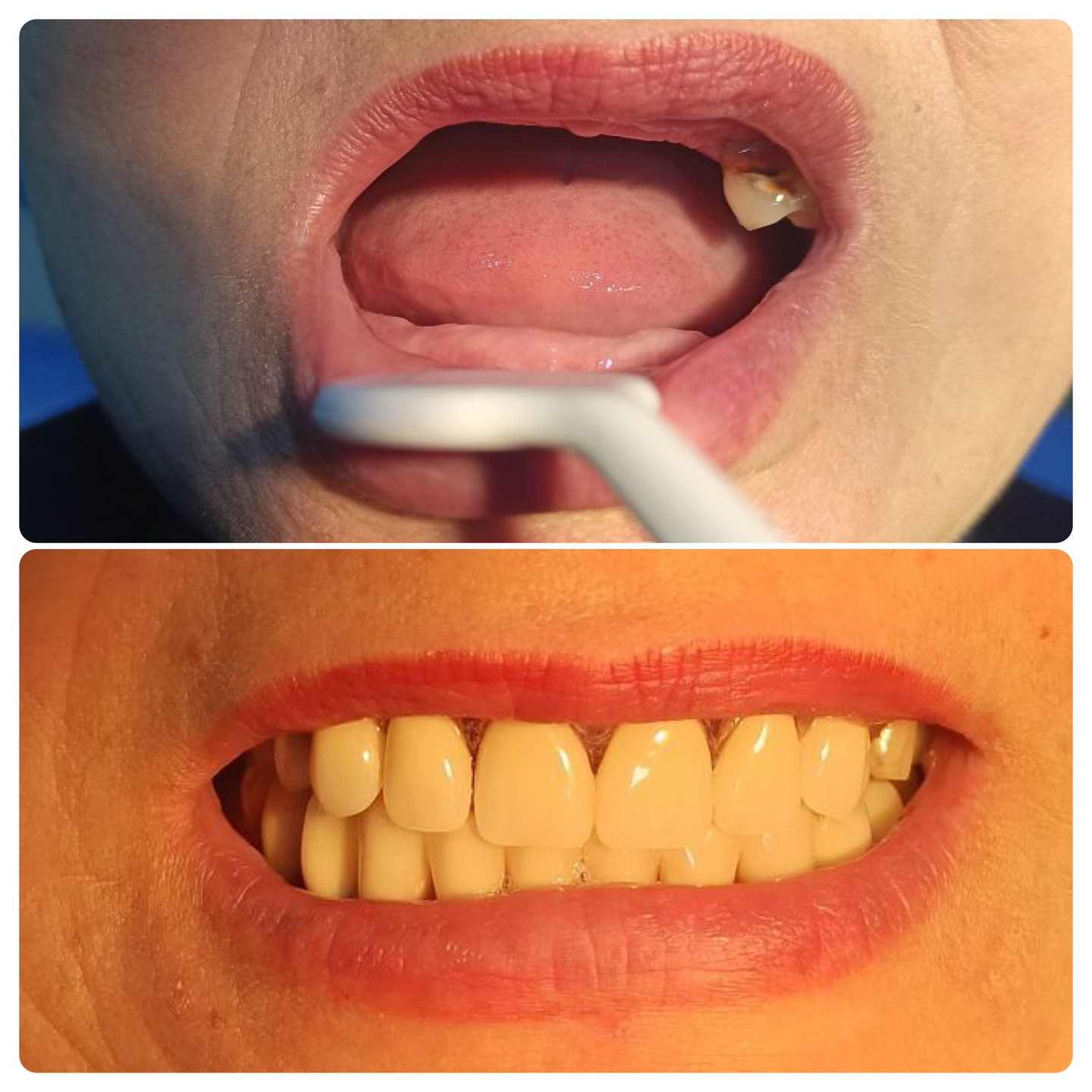 Результат лечения