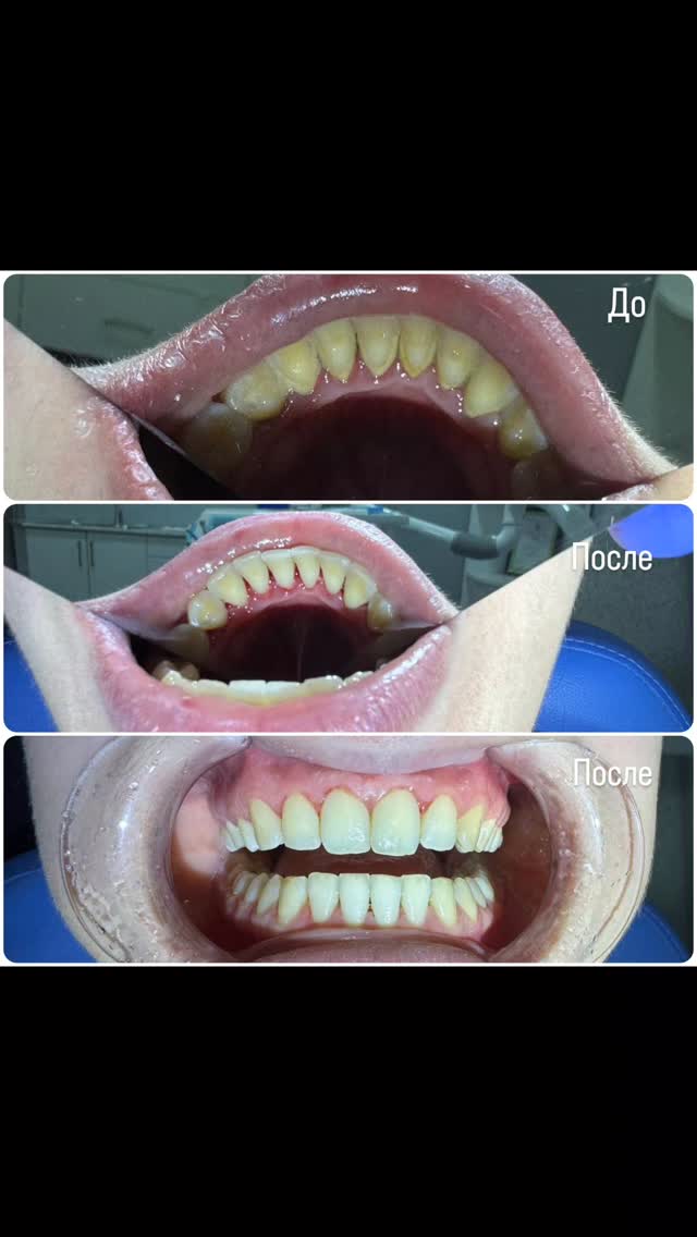 Профессиональная чистка